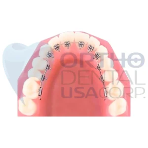 LINGUAL METAL BRACKET / BLIN