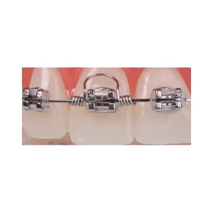 Orthodontic Torquing Coil Springs 10 pcs