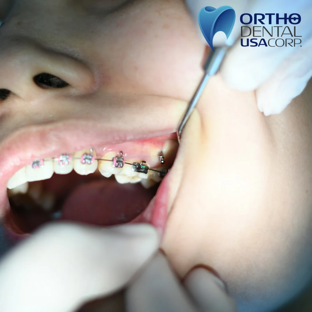 Stage 1: The Initial Consultation (Week 1)

Your journey begins with a comprehensive evaluation where we assess your teeth, bite, and jaw alignment.