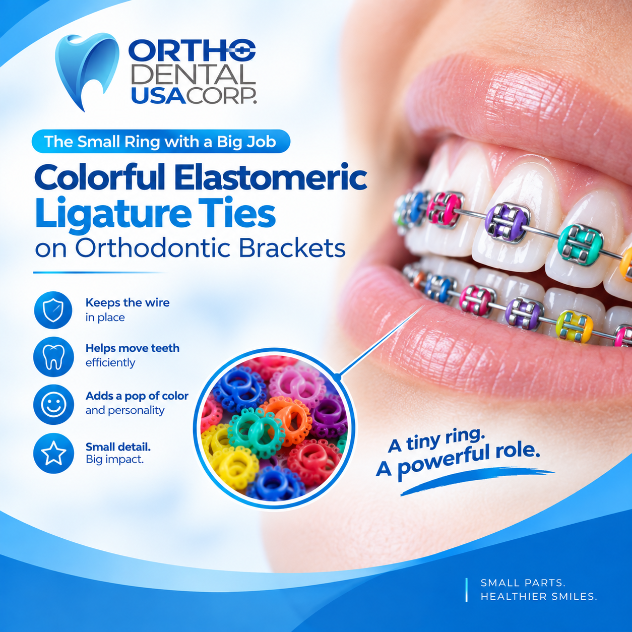 colorful elastomeric ligature ties on orthodontic brackets